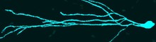 Bridging Brain Barriers Bridging Brain Barriers